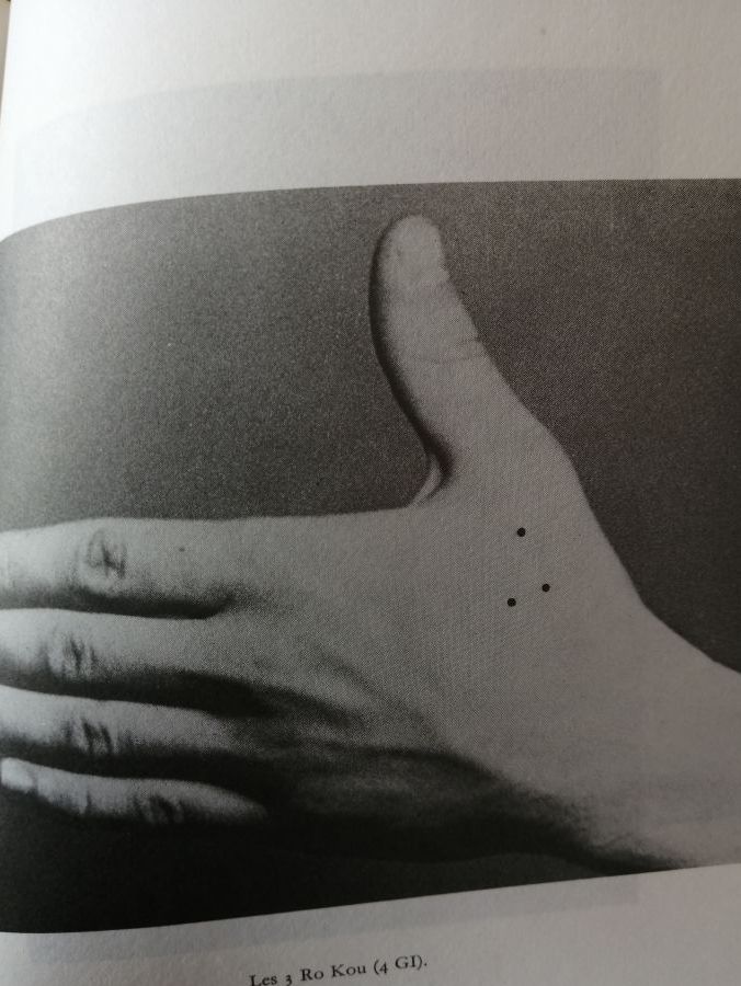 Acupuncture et art dentaire 1974 BORSARELLO Jean François Usage